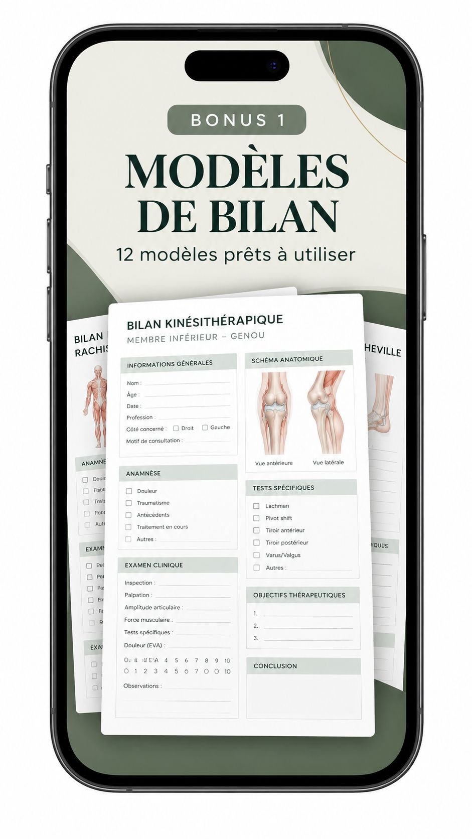 Bonus 1 — Modèles de bilan